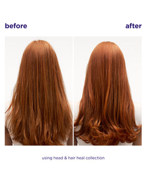 Head & Hair Heal Shampoo Liter