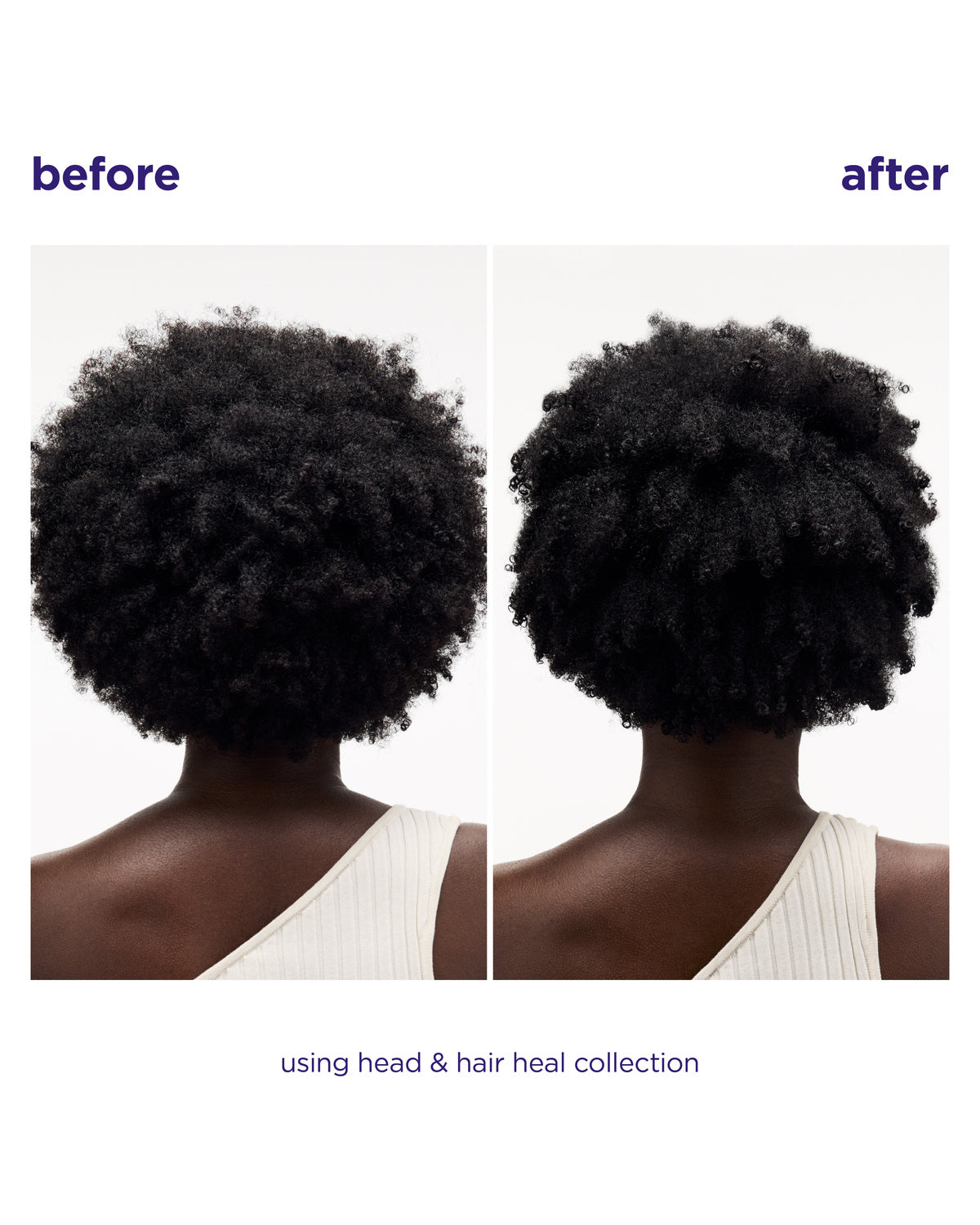 Head & Hair Heal Shampoo Liter